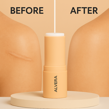 Alvera™ Silicone Scar Stick